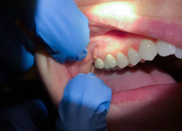 Best Urgent Care for Lost Fillings or Crowns in Livingston, TN