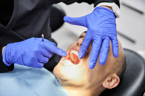 Best Emergency Dental Care for Broken or Chipped Teeth in Livingston, TN